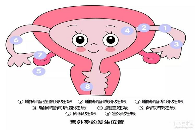 1_1712799185924255372.png 640 (4).png