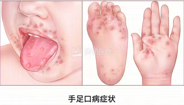 1_1717393299855926514.png 图片1.png