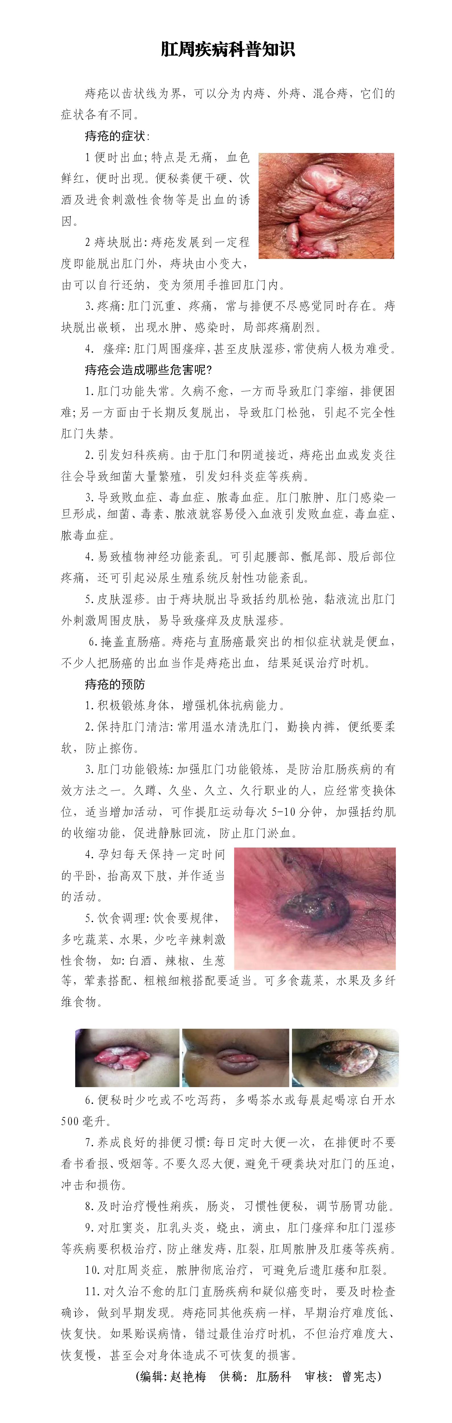 2022年43期肛周疾病科普知识_01.jpg